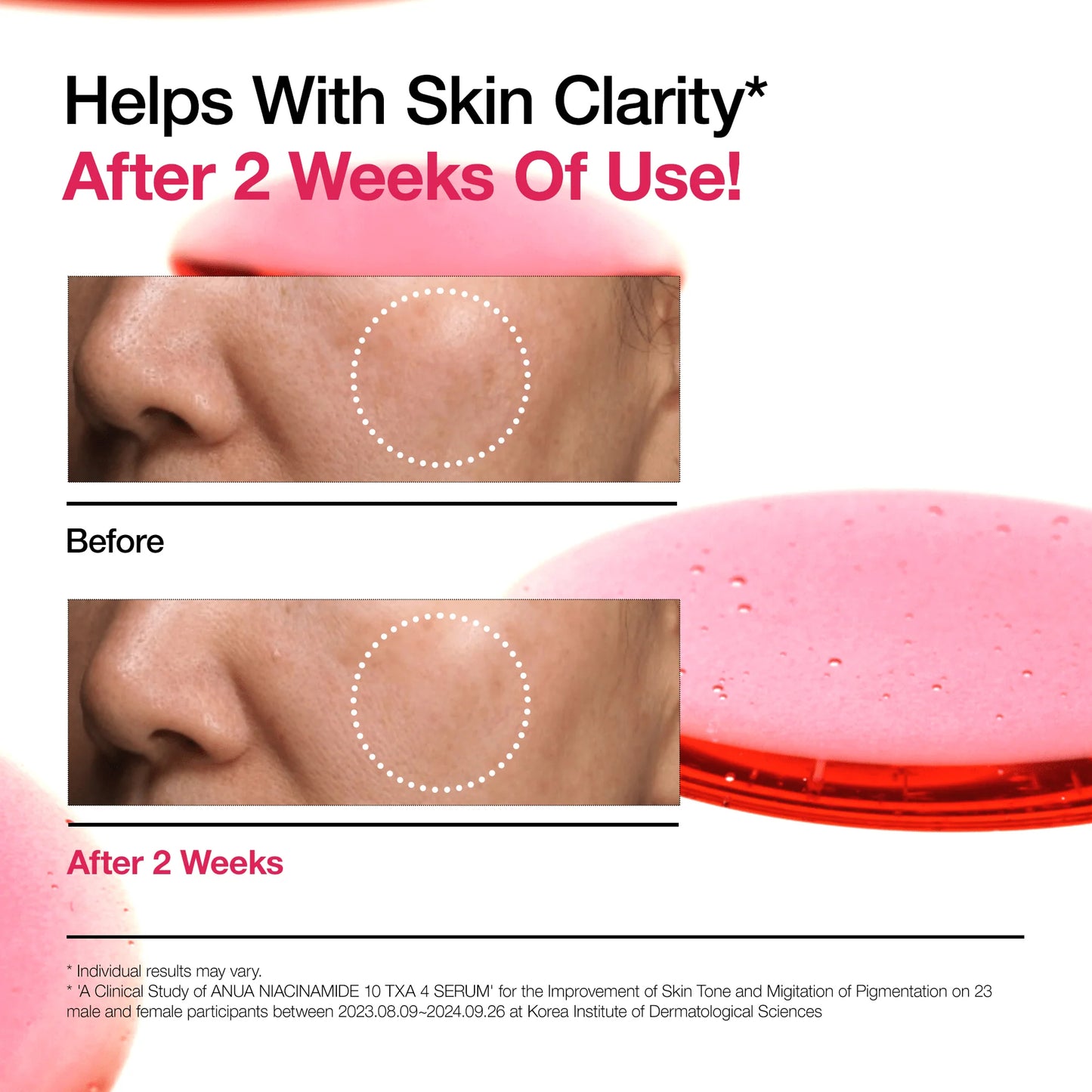 Anua Niacinamide 10 And TXA Serum